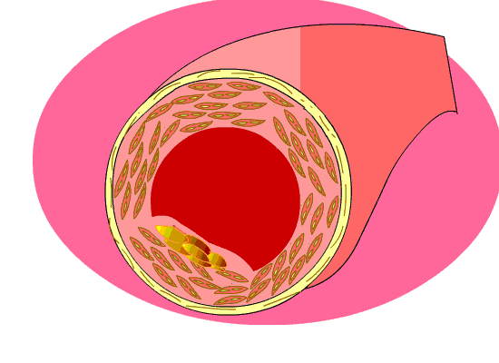 cholesterol animation