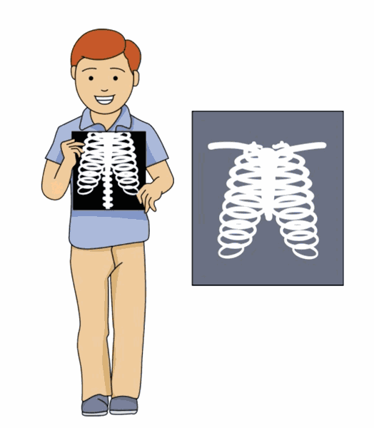 boy holds up his xray animated clipart