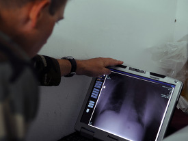 X-rays during surgical screenings