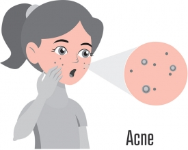 girl with acne on her face gray color