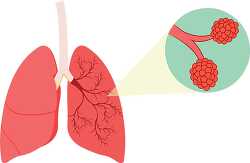 human lungs with bronchus aveoli clipart