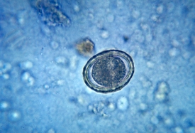 fertilized egg of the round worm