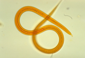 filariform larva