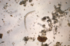 morphologic ultrastructure of a hookworm