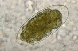 parasitic Trichostrongylus nematode