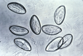 photomicrograph depicts eight eggs of the human pinworm