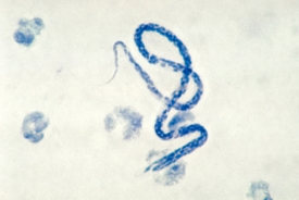 photomicrograph microfilarial parasite