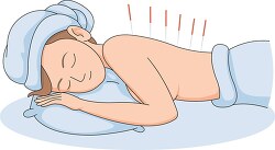 woman with acupuncture needles during therapy clipart