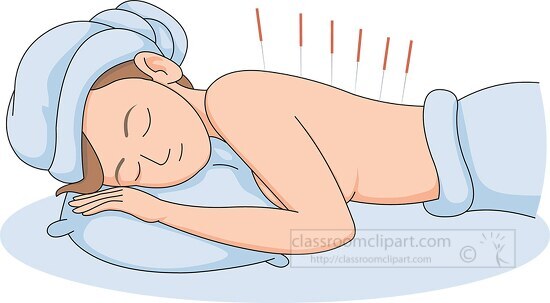 woman with acupuncture needles during therapy clipart