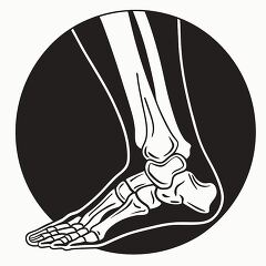 illustration of a human foot and ankle bones showing skeletal st