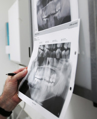Dentist  examines xrays