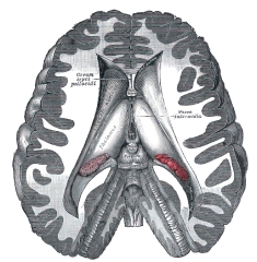 dissection showing ventricles of brain human anatomy