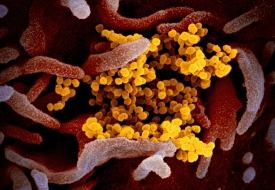 Novel Virus under electron microscope