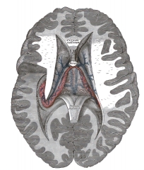 tela chorioidea of third ventricle human anatomy
