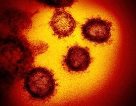 virus that causes COVID-19