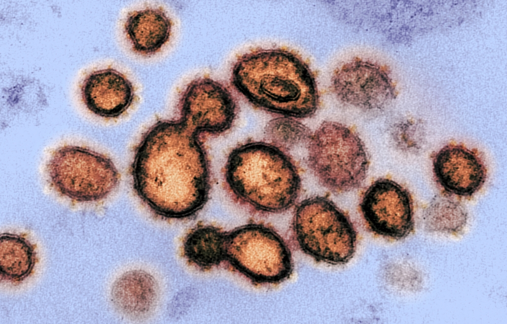 electron microscope image corona virus