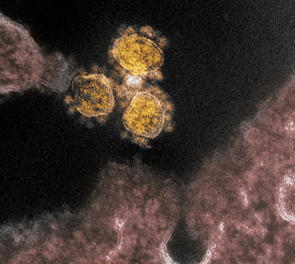 spikes on the outer edge of the virus particles