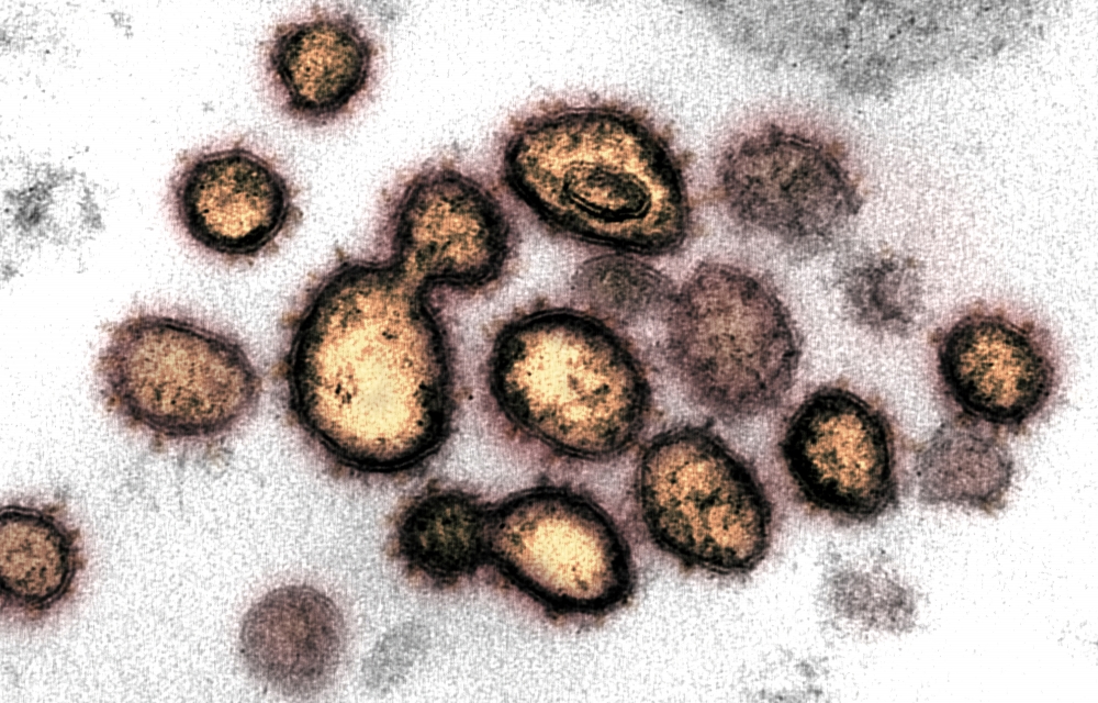 Virus particles are shown emerging