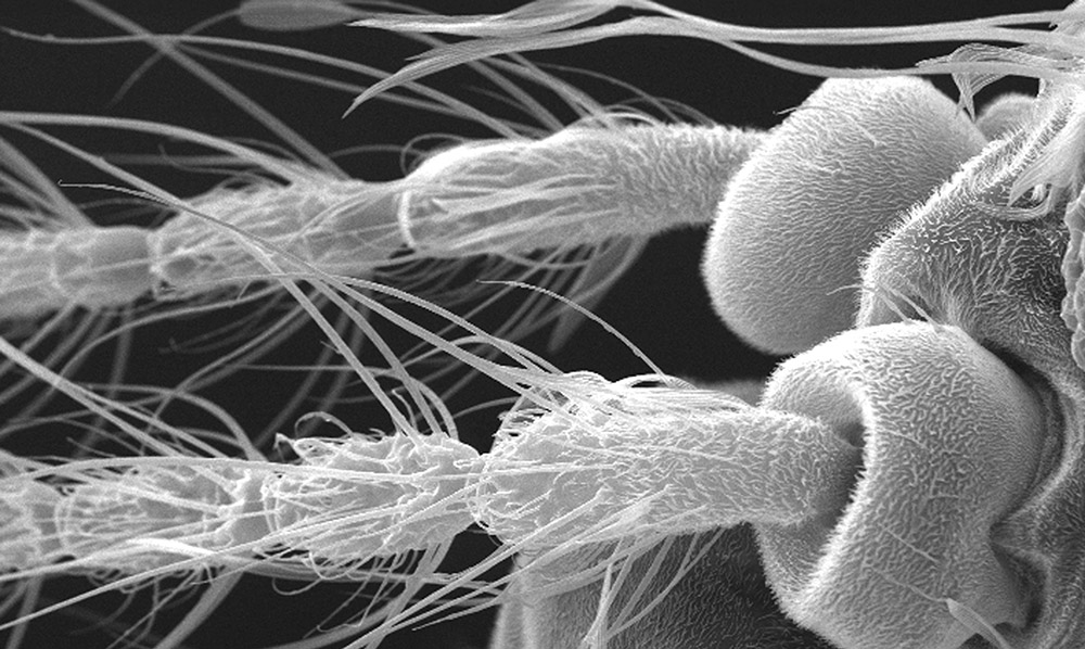 microscopic_mosquito.jpg