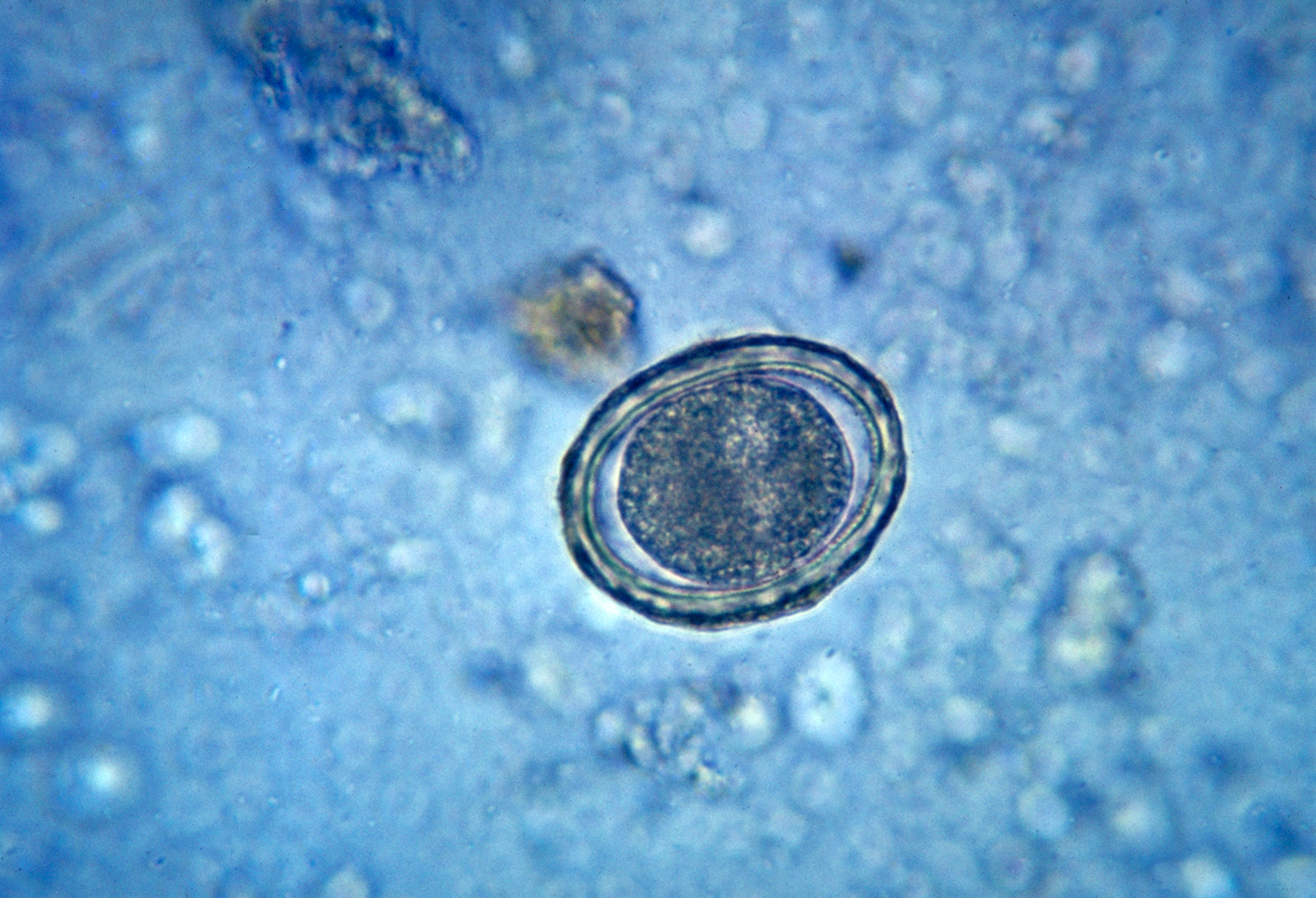 fertilized-egg-of-the-round-worm.jpg
