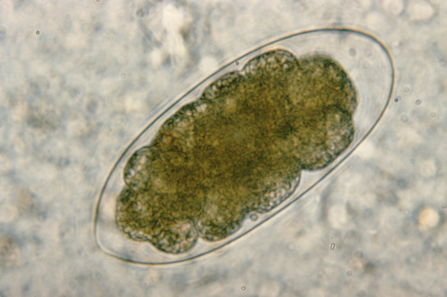parasitic-trichostrongylus-nematode.jpg