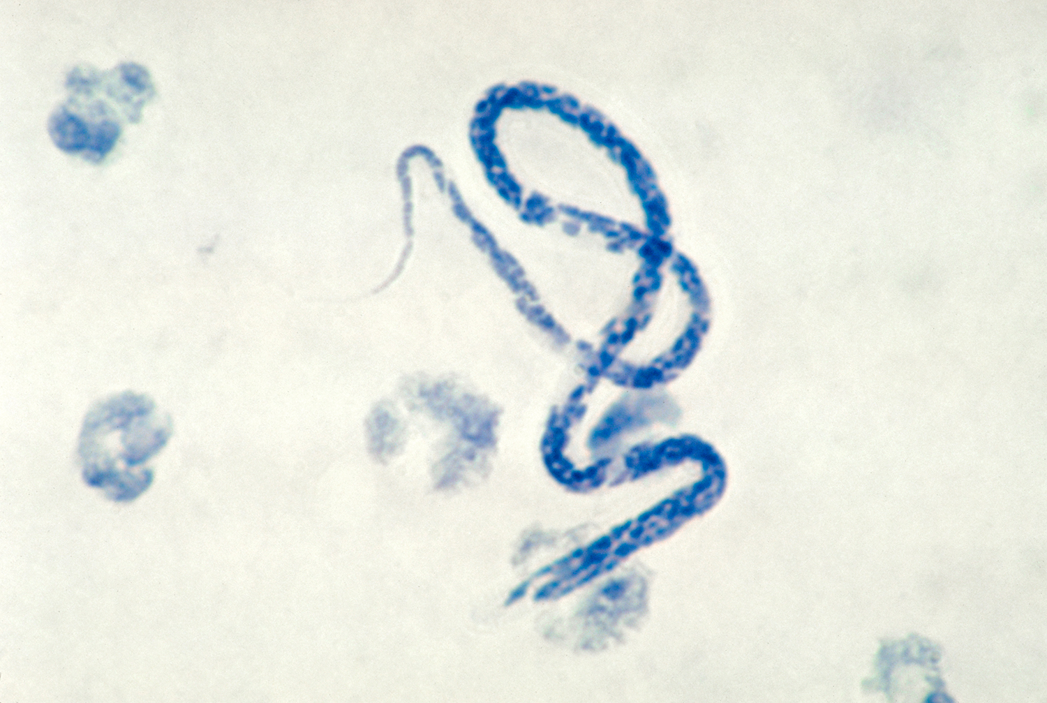 photomicrograph-microfilarial-parasite.jpg