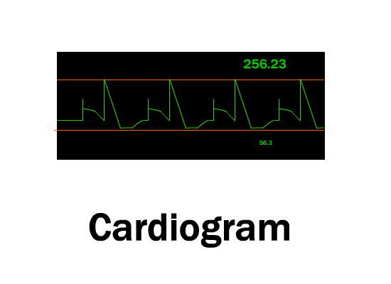 cardiogram_417.gif