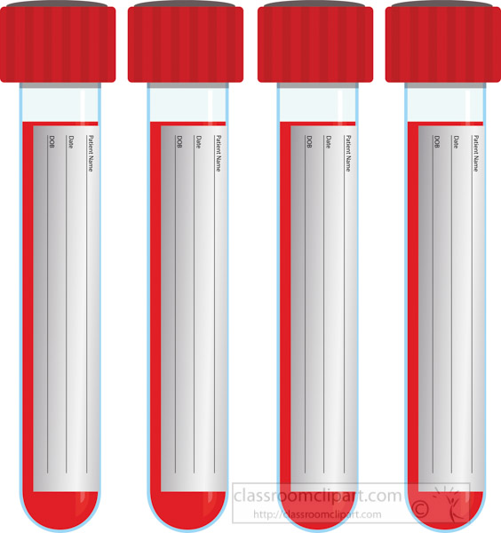 four-vials-of-blood-samples-with-labels.jpg