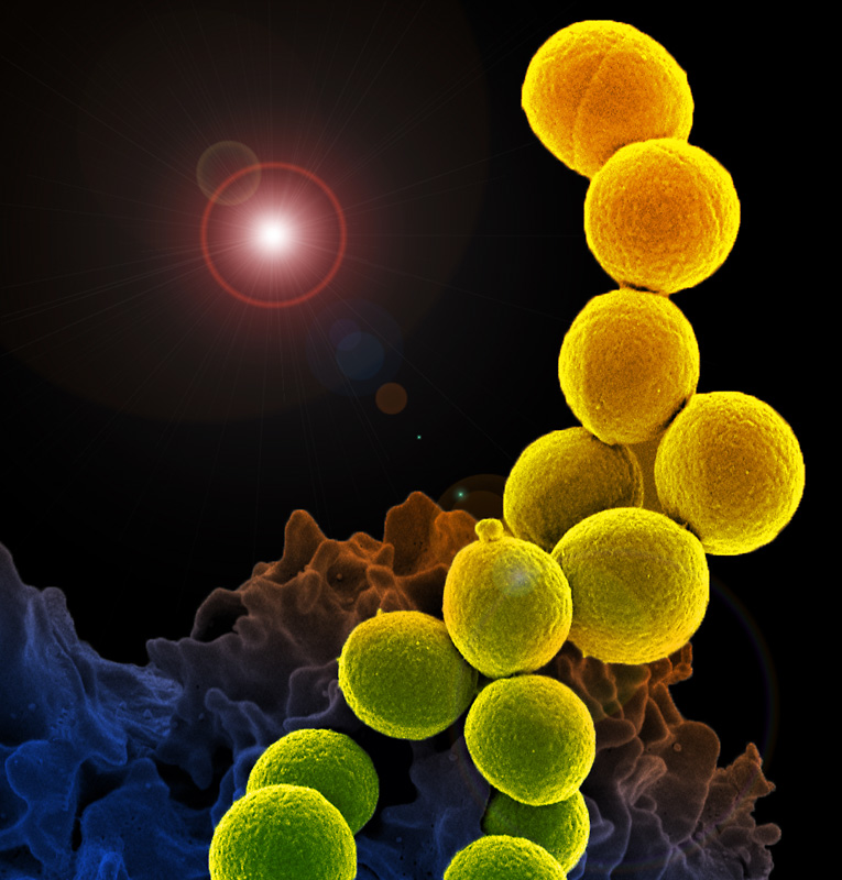 methicillin-resistant-Staphylococcus-aureus-mrsa-bacteria.jpg