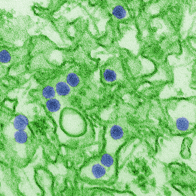 microscopic-image-of-Zika-virus.jpg